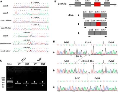 A spectrum of clinical severity of recessive titinopathies in prenatal